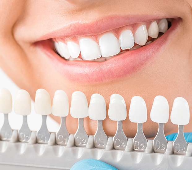 Lewisville Cosmetic Dentist