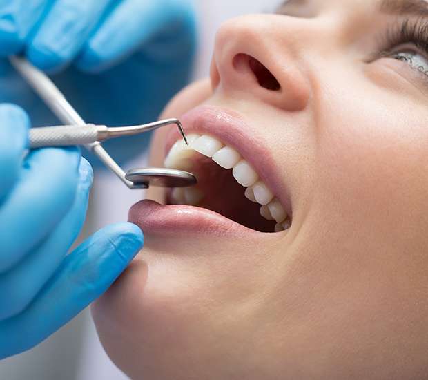 Lewisville Dental Bonding