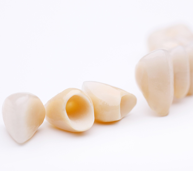 Lewisville Dental Crowns and Dental Bridges