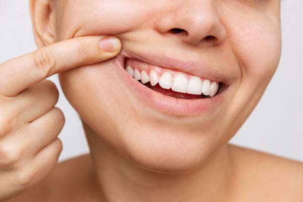 When To Consider A Full Mouth Reconstruction