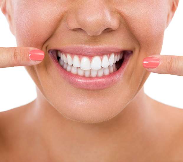 Lewisville What Is Gum Contouring and Reshaping