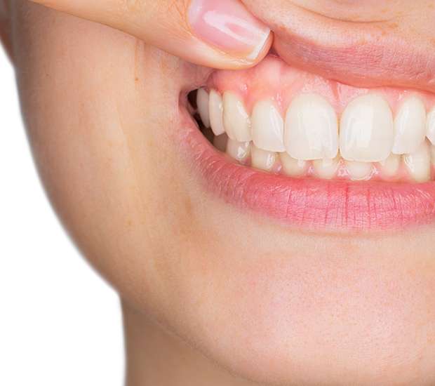 Lewisville Gum Disease