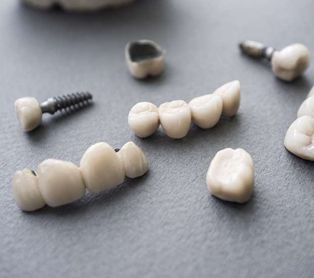 Lewisville The Difference Between Dental Implants and Mini Dental Implants