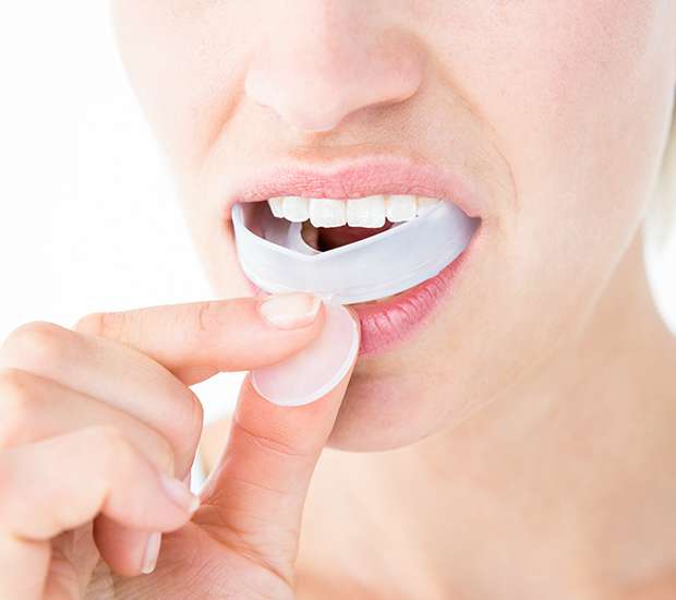 Lewisville Mouth Guards