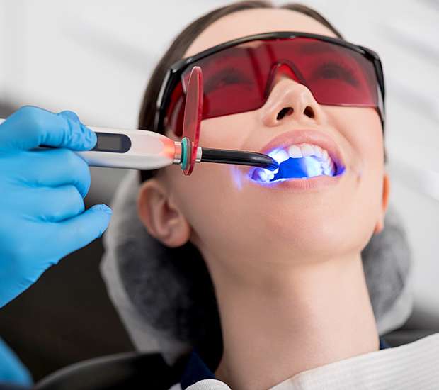 Lewisville Professional Teeth Whitening