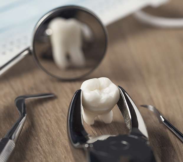 Lewisville When Is a Tooth Extraction Necessary